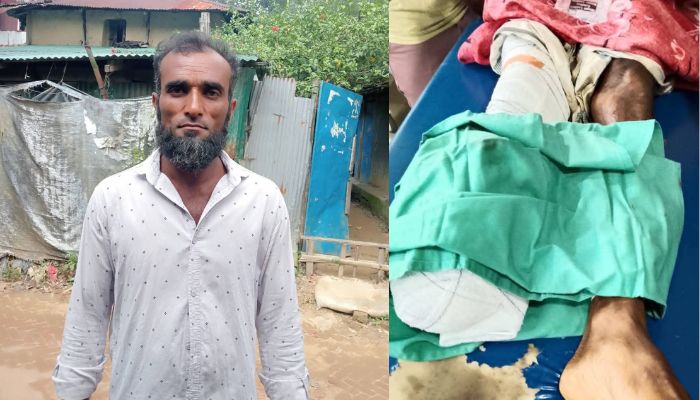 উখিয়ায় সীমান্তে মাইন বিস্ফোরণে জেলের পা বিচ্ছিন্ন, আশঙ্কাজনক অবস্থায় চট্টগ্রাম প্রেরণ